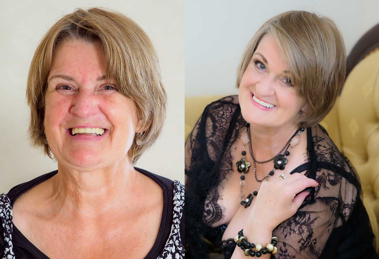 50over 50 project before and after photo